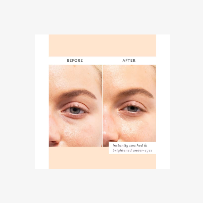 Skin Remedy Soothing Eye Gels