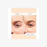 Skin Remedy Soothing Eye Gels